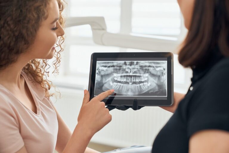 Konsultacja implantologiczna w klinice Artsmile Łódź