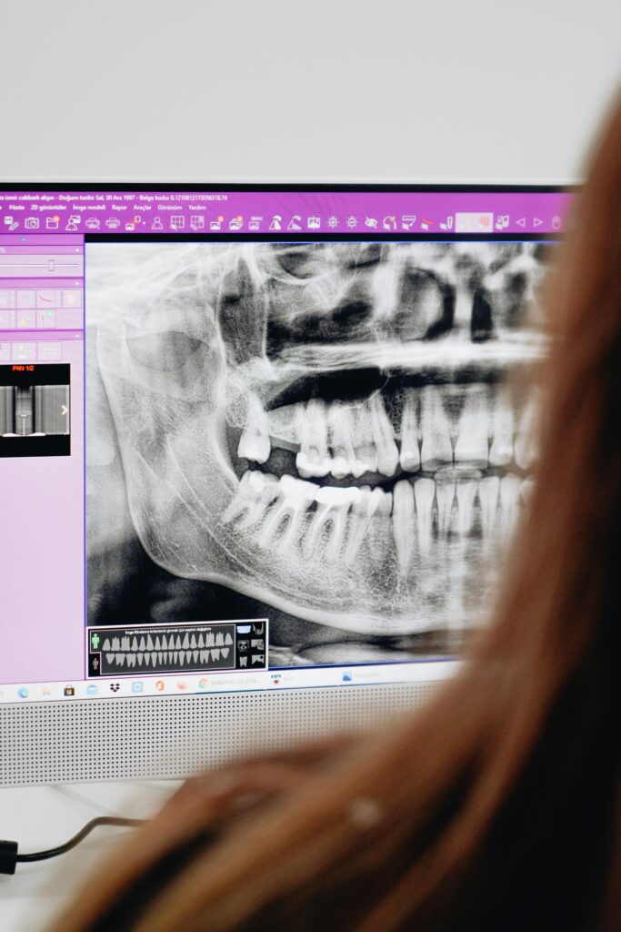 Diagnostyka 3D przed implantacją zęba w Łodzi